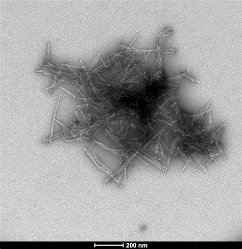 Superoxide disumutase (SOD) Pre-formed Fibrils (SPR-470)