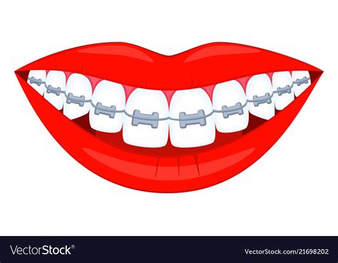 Colorful Cartoon Healthy Smile In Braces Vector Image