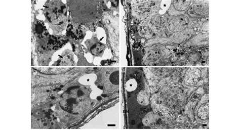 Electron Micrographs Of Seminiferous Tubules From Irradiatedrats And