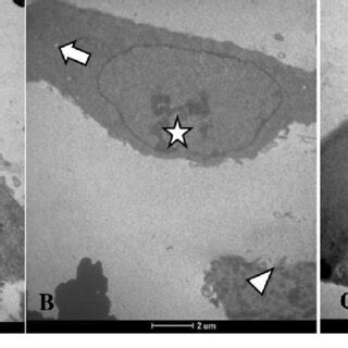 TEM Images Of Untreated And Carmofur Treated MCF 7 Cells For 24 H A