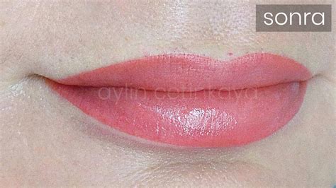 Permanent Lip Color Tattoo In Istanbul Turkey