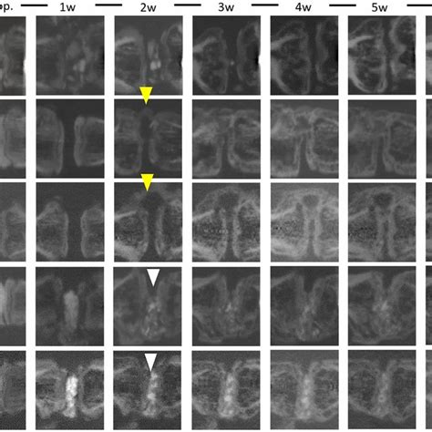 Temporal In Vivo Micro Ct Images Of The Treated Segments In The Ib