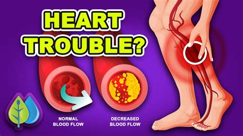 Top Ways Poor Circulation In Legs And Feet Reveal Heart Trouble Youtube