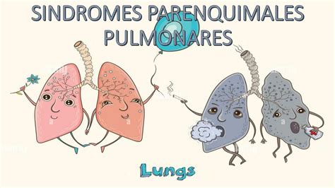 Esquema De Síndromes Parénquimas Pulmonares Briggitte Yamilé Suarez