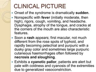 Waterhouse–friderichsen syndrome (wfs) | PPT