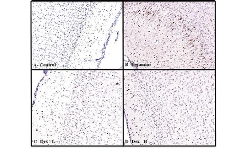 Activated Caspase 3 Ac3 Immunostained Photomicrographs Of The Frontal