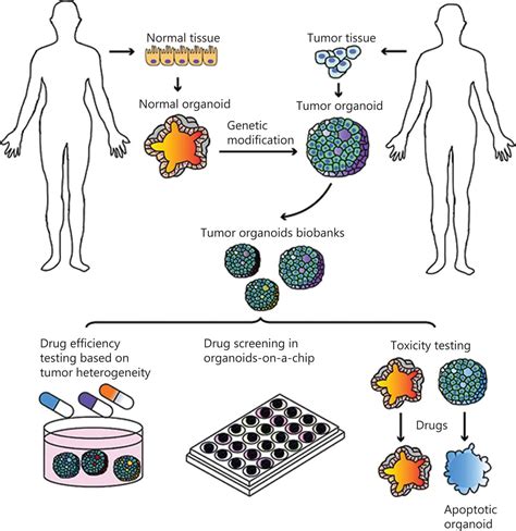 Tumor Organoids For Cancer Research And Personalized Medicine Cancer Biology And Medicine