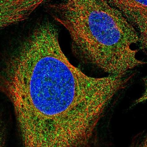 Growth Hormone Receptor Antibody (PA5-66102)