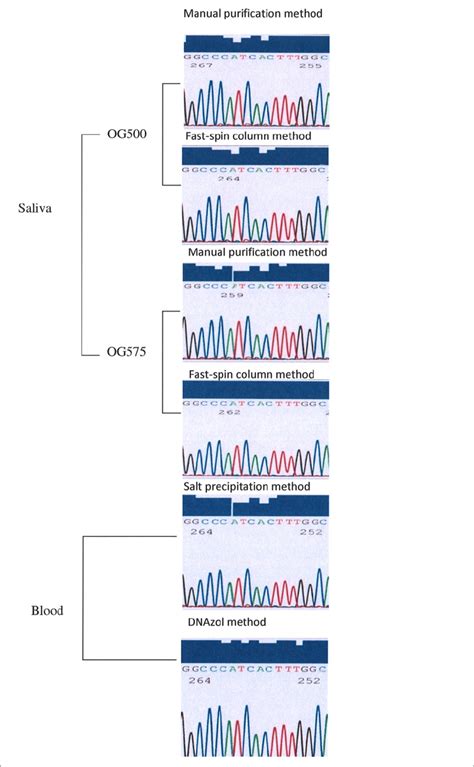 Sample Beta Globin Gene Sequence Trace Files The Sequences Are From