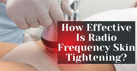 How Effective Is Radio Frequency Skin Tightening