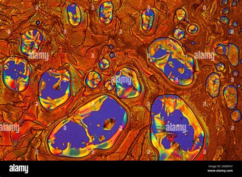 Vitamin C Crystals Polarized Light Micrograph Of Crystals Of Vitamin C