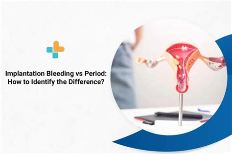 Implantation Bleeding Vs Period How To Identify The Difference By Ayu Health Hospitals Medium