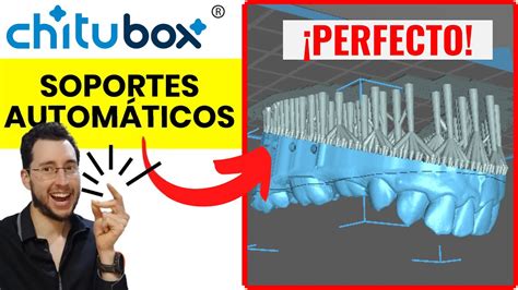 🪄 Soportes AutomÁticos Perfectos Guía De Chitubox Con 1️⃣ Clic Youtube