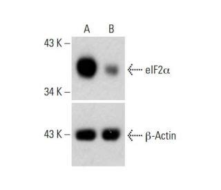 Eif Alpha Crispr Knockout And Activation Products H Scbt Santa