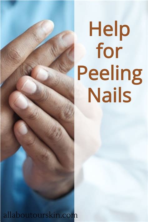 Help For Peeling Nails Peeling Nails Dry Skin Conditions Dry Nails