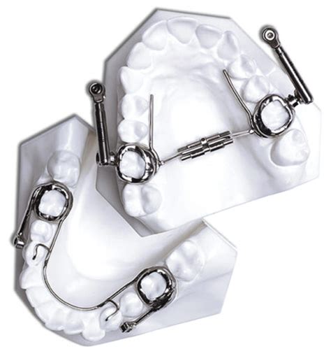 Types Of Appliances Galeano Orthodontics