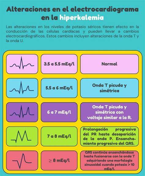 Alteraciones en el electrocardiograma en la elevación del potasio