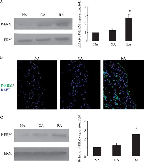 Pdf Increased Phosphorylation Of Ezrin Radixin Moesin Proteins