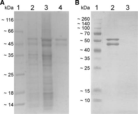 Combined Use Of Elisa And Western Blot With Recombinant N Protein Is A