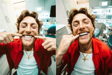 Bailey Zimmerman Reveals His Brand New Smile After Getting Veneers