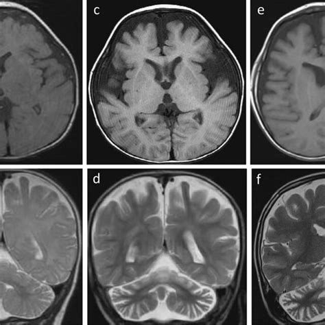 SHQ1 Regulates Neuronal Cell Migration Human SH SY5Y Cells Were