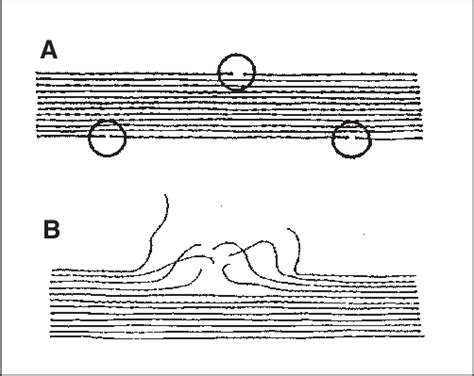 A Attack On The Crystalline Domain B Amorphous Regions Developing