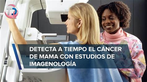 Estudios De Imagenolog A Nica Forma Para Detectar A Tiempo C Ncer De