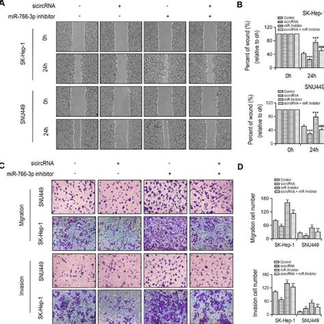 Silencing Of Hsa Circ Repressed Cell Migration And Invasion In