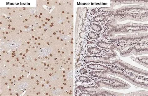 FUS Antibody HL2454 Azide And BSA Free NBP3 25471 By Novus Part