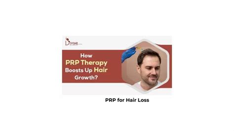 Ppt Prp For Hair Loss Powerpoint Presentation Free Download Id12877656