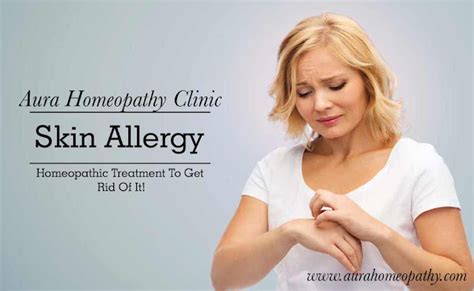 Skin Allergies Homeopathic Medicine Treatment Complete Overview