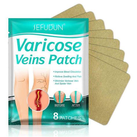 Varicose Veins Patch Relief Leg Vasculitis Spider Varicose Vein Patches