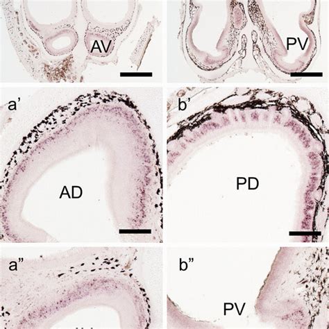 In Situ Hybridization Analysis For The Expression Of The Gene Encoding