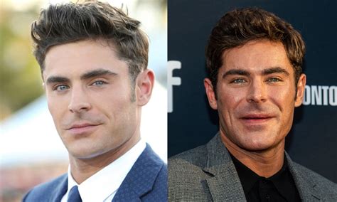 ¡qué Le Pasó Zac Efron Explica Por Qué Su Cara Luce Irreconocible