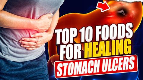 Top 10 Foods To Heal Your Stomach Ulcer Naturally Youtube