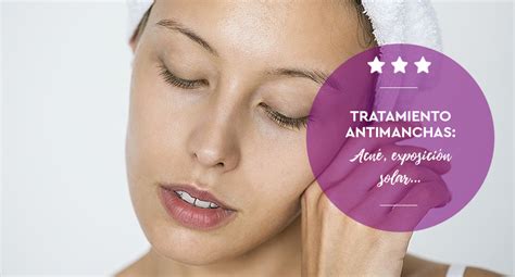 Tratamiento Antimanchas Faciales Para La Piel Con Acn O Manchas De Sol