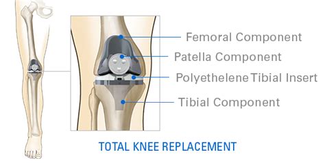 Knee Care In Muskegon And Grand Haven Mi Orthopaedic Associates Of