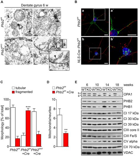 Defective Mitochondrial Morphogenesis And Ultrastructure In