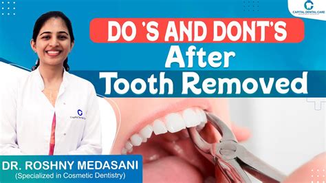 Do S And Don Ts After Wisdom Teeth Removal Tooth Extraction After