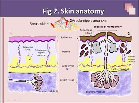 Superficial Breast Lesions A Comprehensive Review Of Skin And