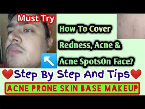 How To Cover ACNE And REDNESS With Makeup Basemakeup Trending