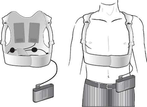 Figure From The Wearable Cardioverter Defibrillator Semantic Scholar