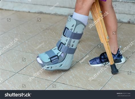 Broken Leg Splint Treatment Injuries Broken Stock Photo (Edit Now ...