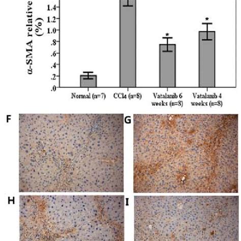 Vatalanib Attenuates The Extent Of Liver Fibrosis In Ccl Stimulated