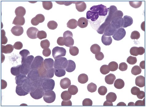 The Feline Blood Film 1 Techniques And Erythrocyte Morphology John