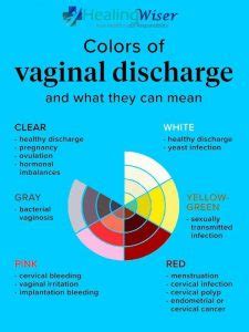 Know the Colors of Vaginal Discharge!