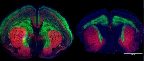 Autism Linked Gene Causes Brai [image] Eurekalert Science News Releases