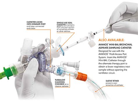 Ballard Multi Access Port Closed Suction System Technopath