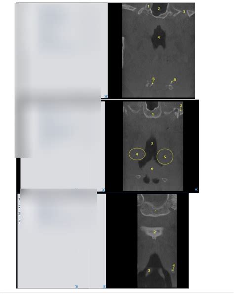 Coronal Imaging Part 2 Diagram Quizlet