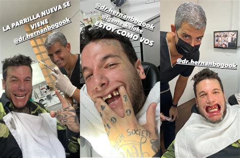 Alex Caniggia mostró fotos de sus dientes reales y se comparó con L